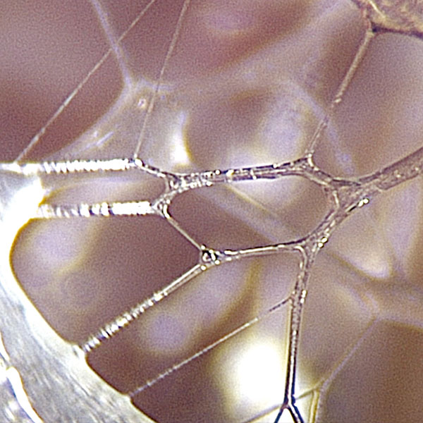 Endovivo