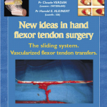 New ideas in hand flexor tendon surgery