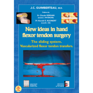 New ideas in hand flexor tendon surgery