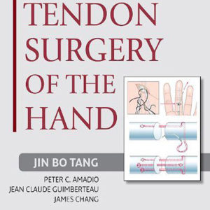 tendon surgery of the hand